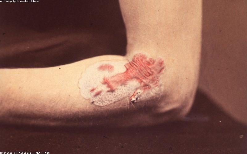 Hỗ trợ hệ miễn dịch bằng mật ong rừng