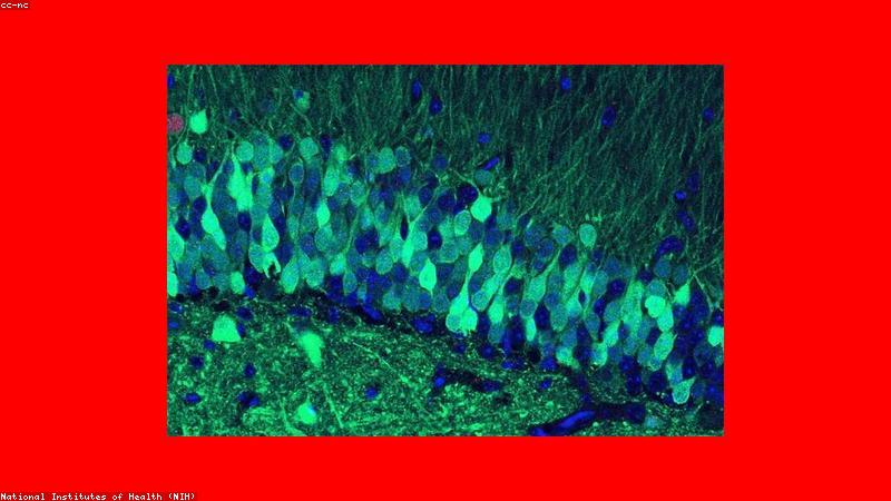 Kỹ thuật lặp lại ngắt quãng