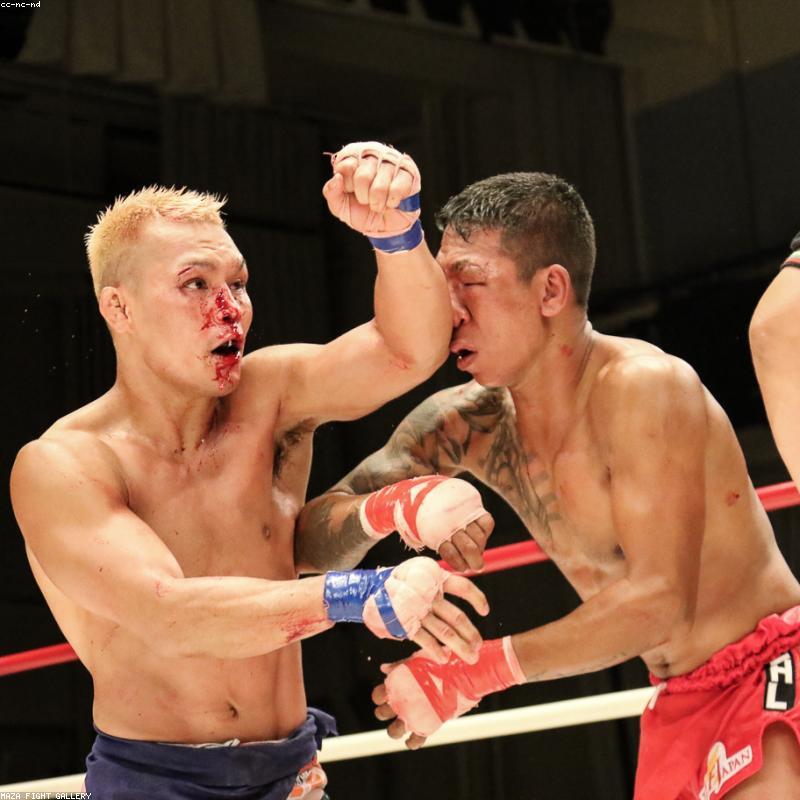 Nhẫn cưới Kim cương Eternal Love