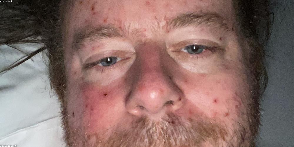 Bữa ăn lành mạnh cho người tiểu đường