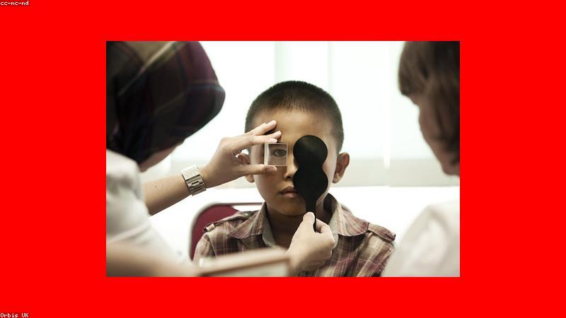 Bác sĩ nhãn khoa tư vấn về tròng kính