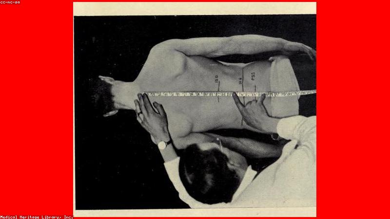 Các loại đai lưng hỗ trợ cột sống