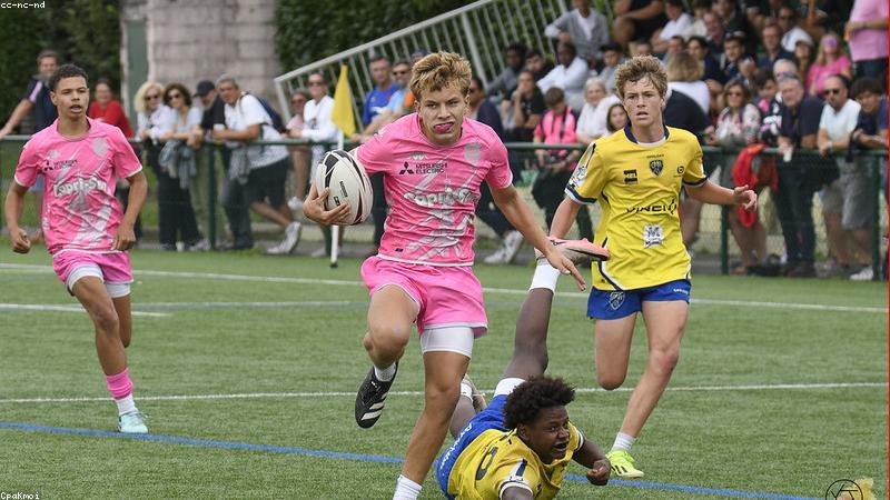 Khay niềng răng trong suốt