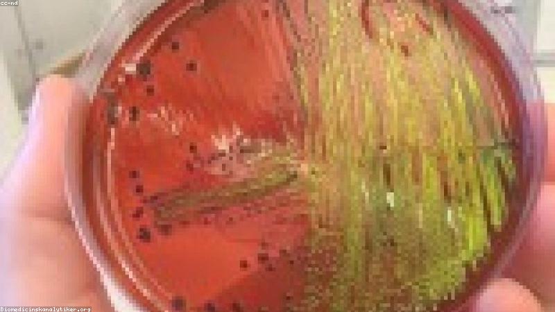 Cơ chế tiêu diệt vi khuẩn của tia UV