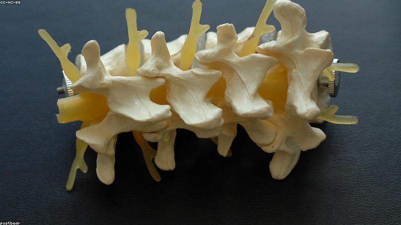 Cách đeo đai lưng chuẩn y khoa