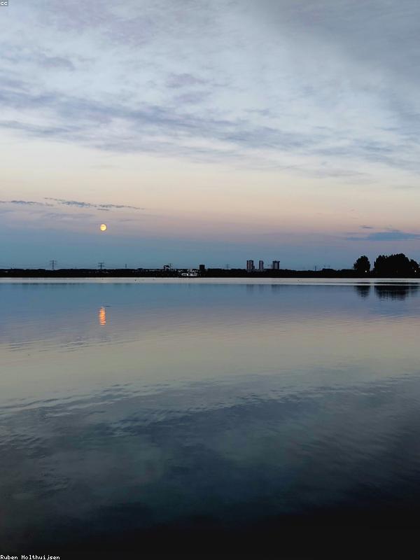 Skin Texture Under Microscope