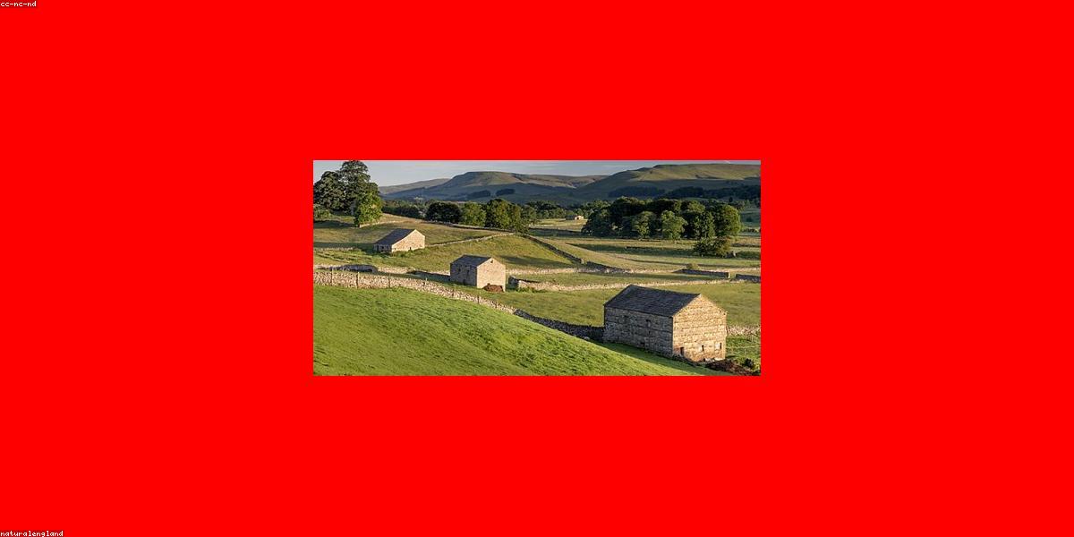 Kết quả phục hình Implant All-on-4