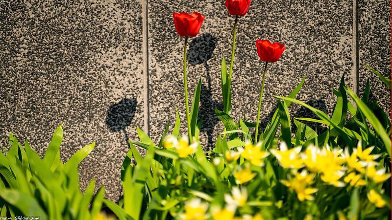 Xét nghiệm vi khuẩn phụ khoa